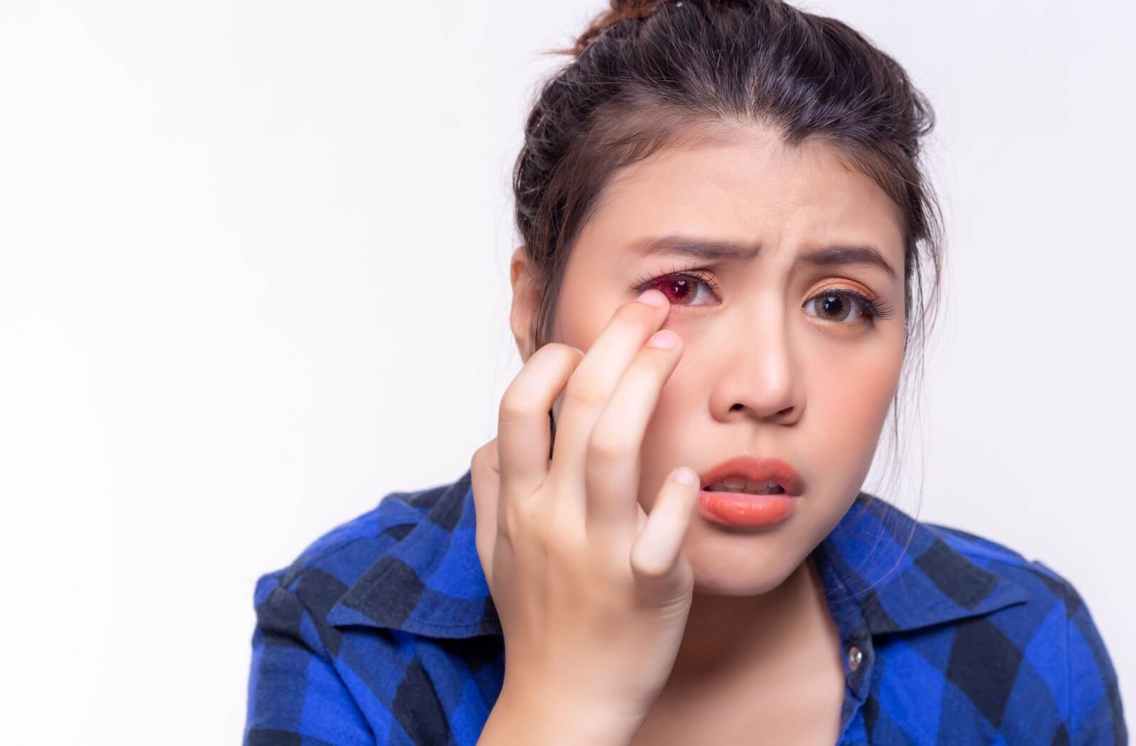 A concerned-looking individual holds a finger to their eye, red and irritated from wearing contact lenses